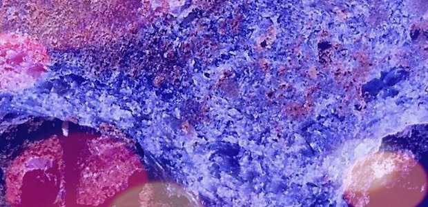Finsaluminous